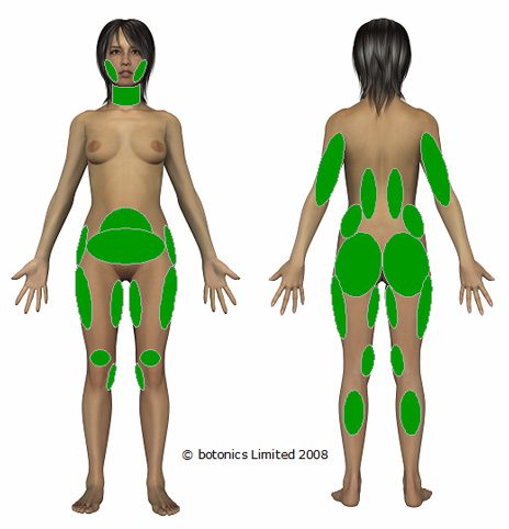 Treatbales areas for women