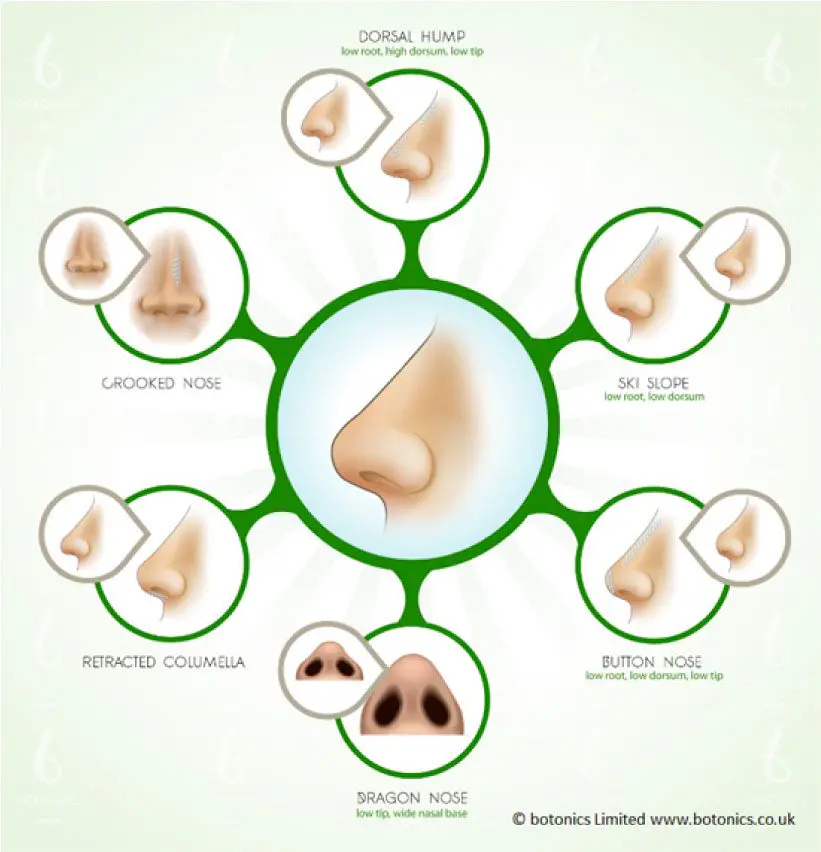 Nose Types That Can be Improved