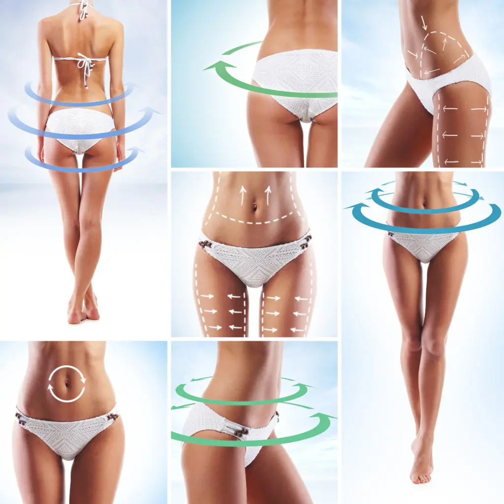 Vaser Lipo