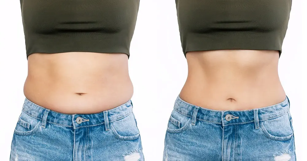 Vaser Liposuction Recovery: Tips To Recover Quickly