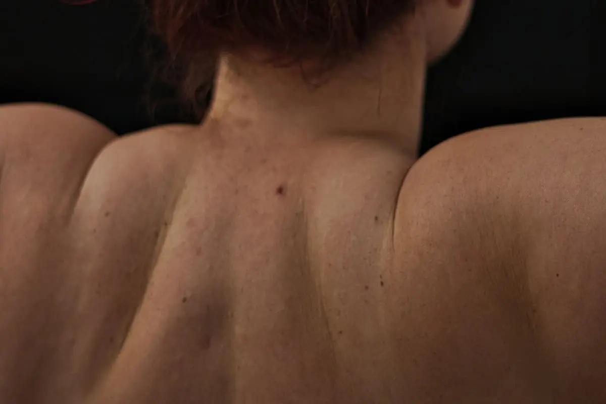 How to get rid of back acne: a practical step-by-step
