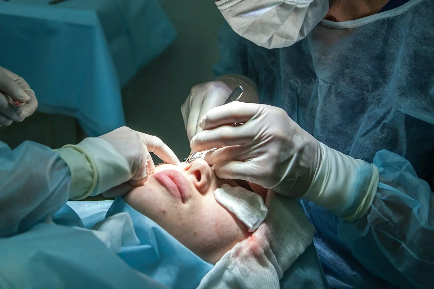 Is chin liposuction right for you?
