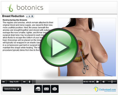botonics 3D Animation of Breast Reduction Procedure