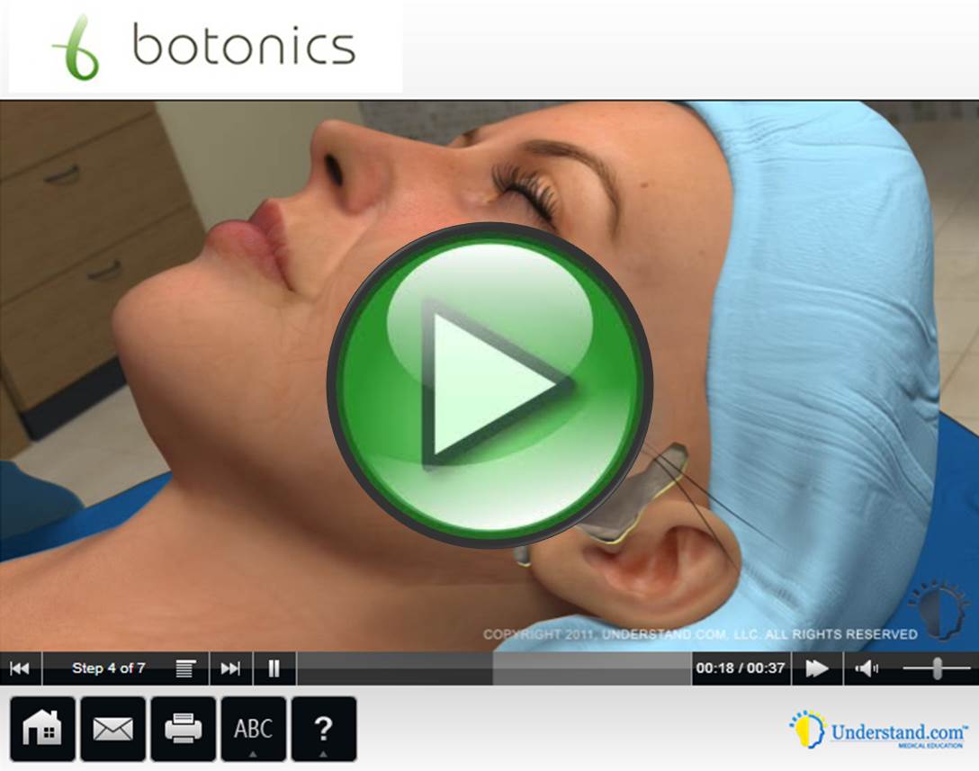 botonics 3D Animation of Mini Face Lift Procedure
