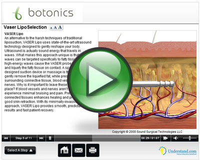 botonics 3D Animation of Vaser Lipo Procedure