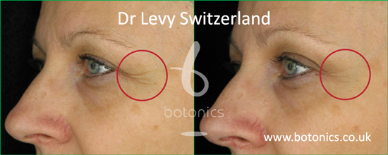 dr levy eye serum