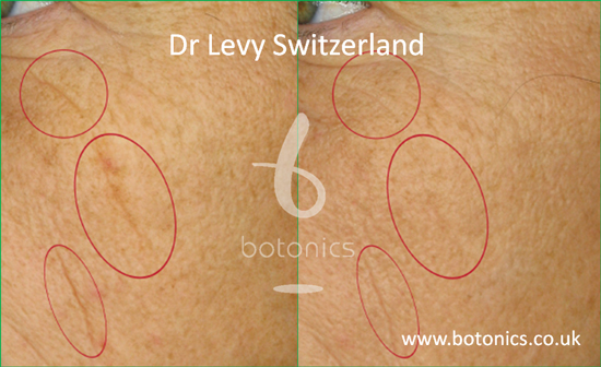 dr levy intense stem cell booster serum