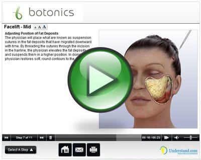 Full Face Lift Animation