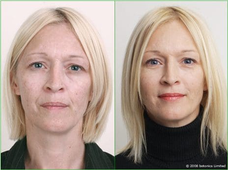 Angela - Before and After