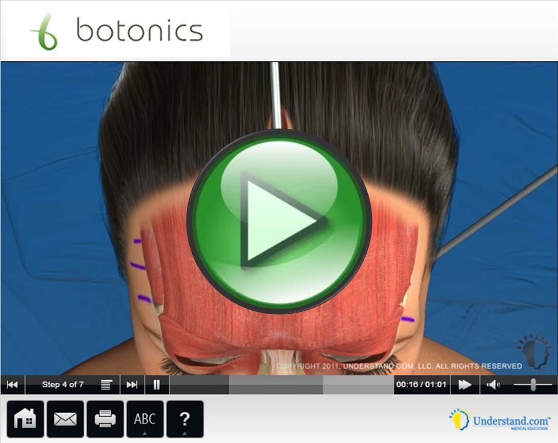 Forehead Face Lift Animation