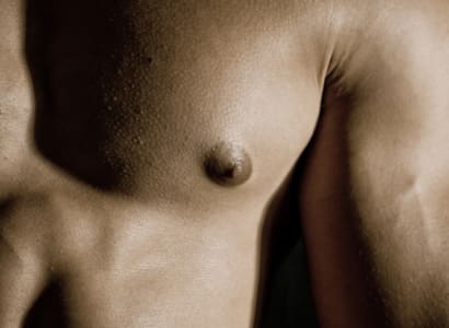 Gynaecomastia – causes and cure