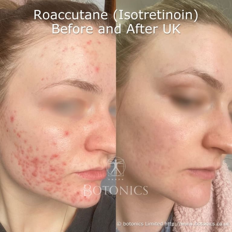 Before and After Four